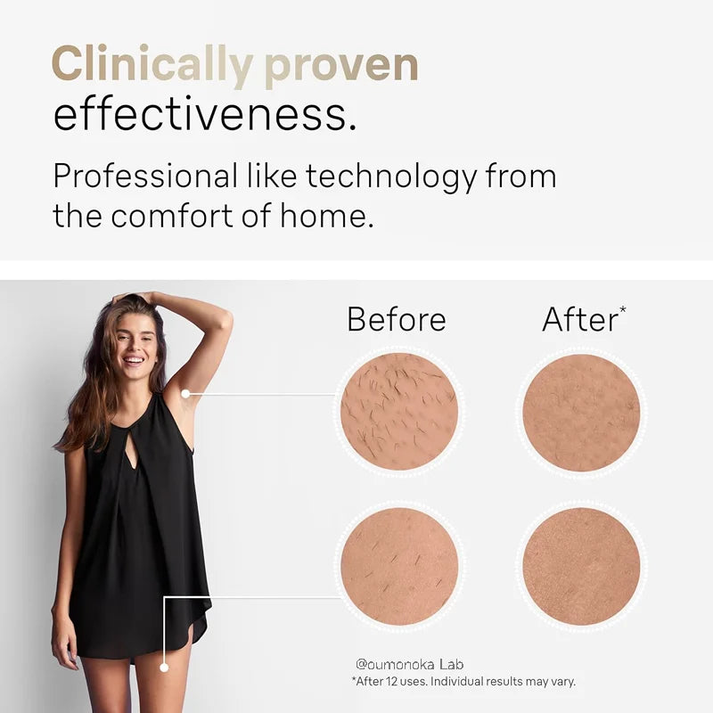 IPL hair removal device for home use for women and men